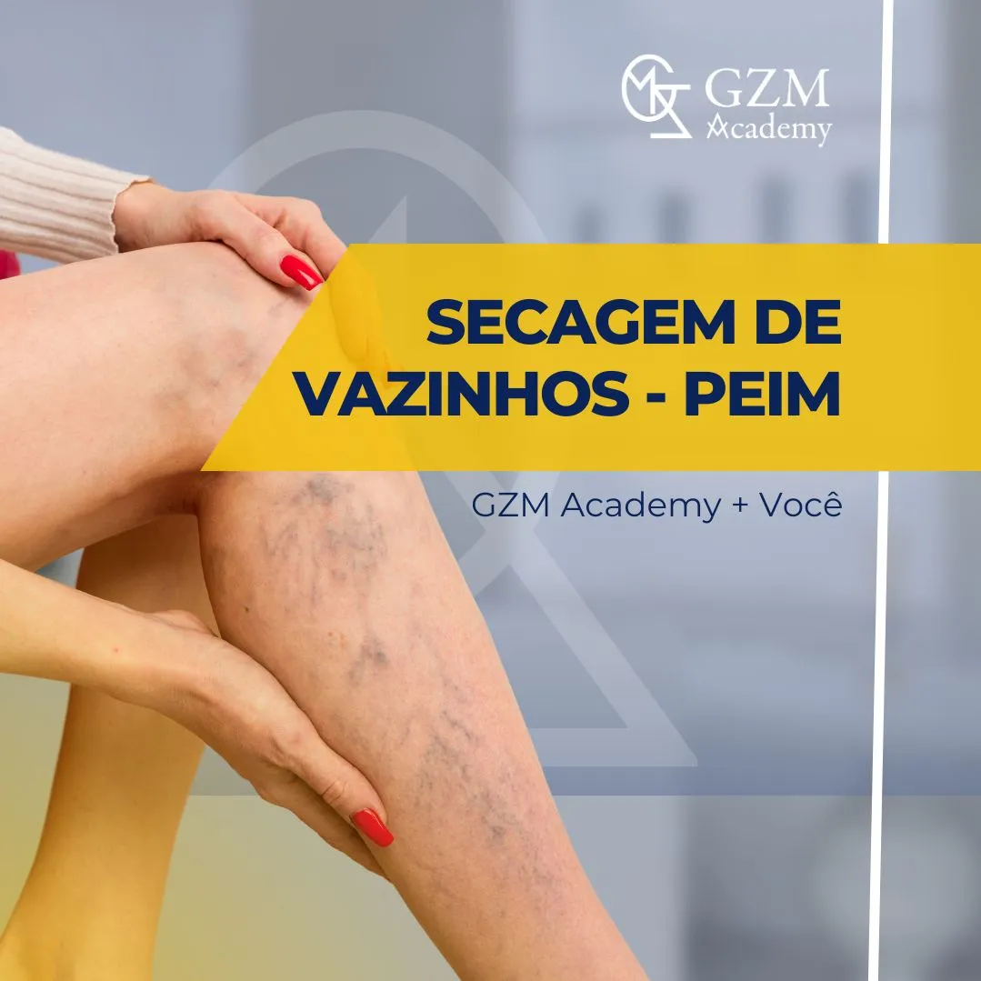 Curso de Secagem de Vasinhos para Profissionais da Saúde Estética